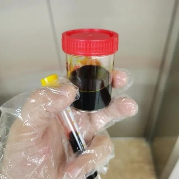 急性肝衰竭！兩兄弟誤吃這種菌 專家提醒